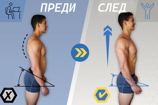 Съвети за корекция на стойката и гърба - полезни уреди